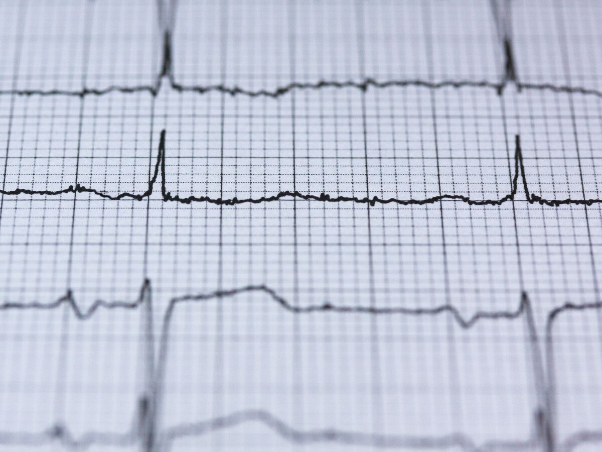 Medical Monitoring
