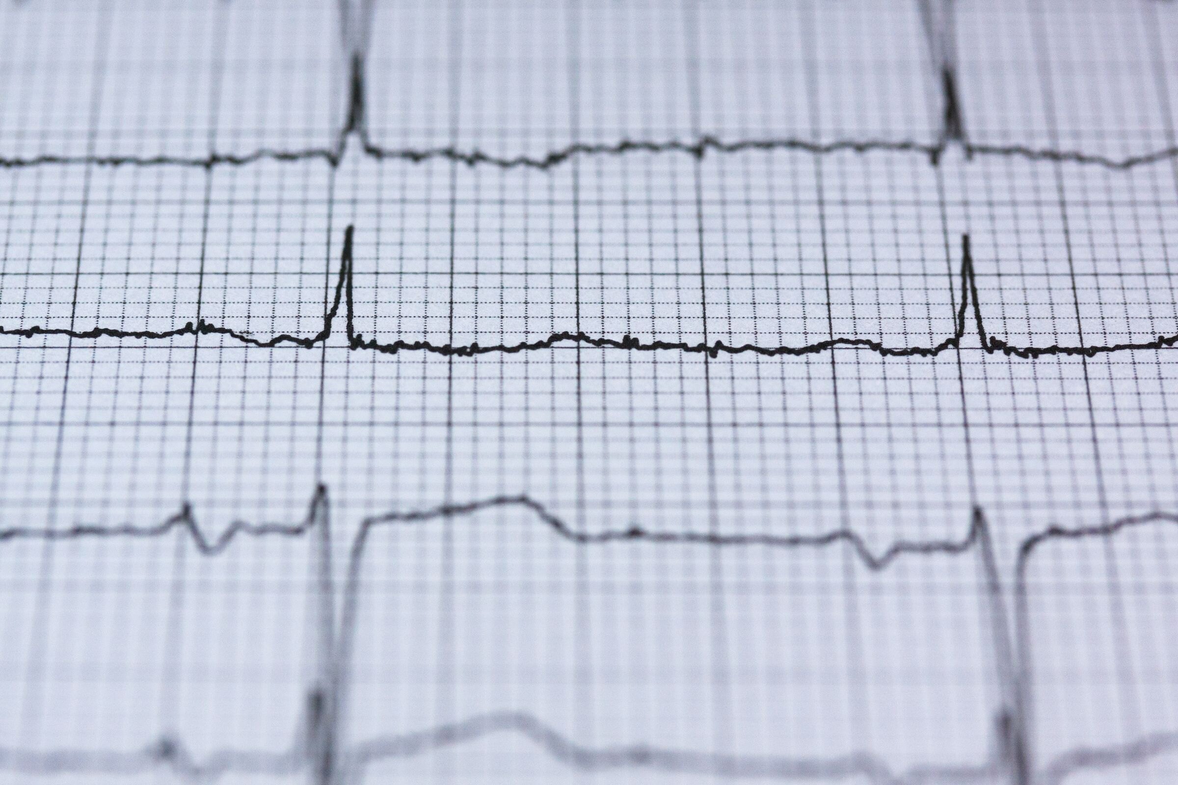Medical Monitoring